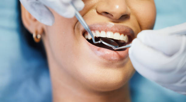 Best Urgent Care for Lost Fillings or Crowns in Strathmore, CA